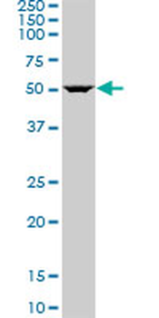 ARHGAP1 polyclonal antibody (A01)