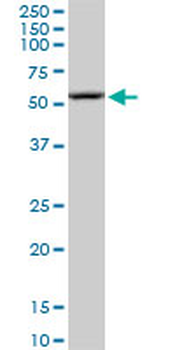 ARHGAP1 polyclonal antibody (A01)