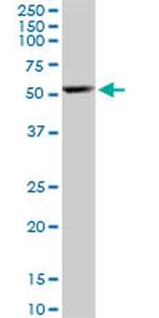 ARHGAP1 polyclonal antibody (A01)