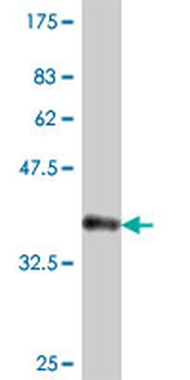 ARHGAP1 polyclonal antibody (A01)