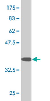 RHOG monoclonal antibody (M05), clone 2E6