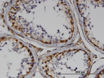 RND3 monoclonal antibody (M01), clone 1D2