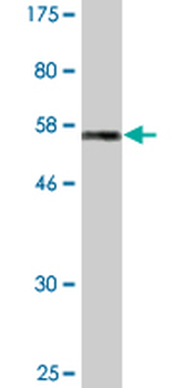RND3 monoclonal antibody (M01), clone 1D2