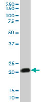 RHOC monoclonal antibody (M06), clone 1B7