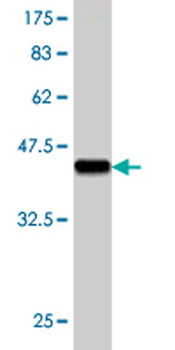 RHOC monoclonal antibody (M06), clone 1B7