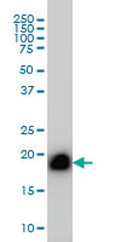 RHOA monoclonal antibody (M06), clone 1C10