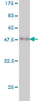 RHOA monoclonal antibody (M06), clone 1C10
