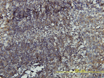 RHOA monoclonal antibody (M05), clone 1C1