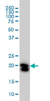 RHOA monoclonal antibody (M05), clone 1C1