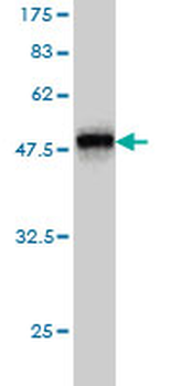RHOA monoclonal antibody (M05), clone 1C1