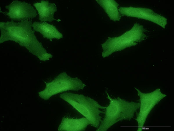 RHOA monoclonal antibody (M04J), clone 1B12