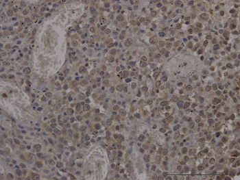 RHOA monoclonal antibody (M04J), clone 1B12