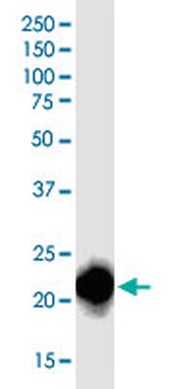 RHOA monoclonal antibody (M04J), clone 1B12