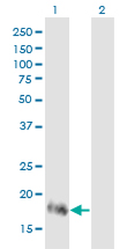 RHOA monoclonal antibody (M04J), clone 1B12