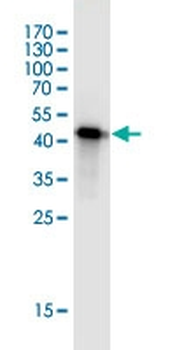 RHOA monoclonal antibody (M04J), clone 1B12