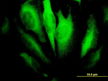 RHOA monoclonal antibody (M04), clone 1B12
