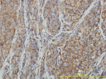 RHOA monoclonal antibody (M04), clone 1B12