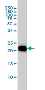 RHOA monoclonal antibody (M04), clone 1B12