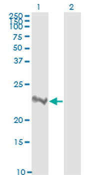 RHOA monoclonal antibody (M04), clone 1B12