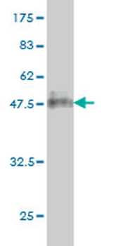 RHOA monoclonal antibody (M04), clone 1B12