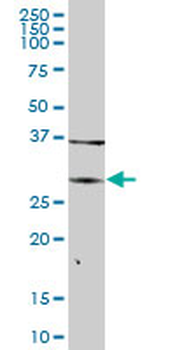 ARG1 purified MaxPab mouse polyclonal antibody (B02P)