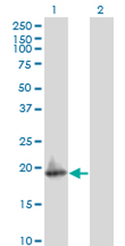 ARF5 monoclonal antibody (M02), clone 1B6