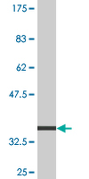 ARF5 monoclonal antibody (M02), clone 1B6