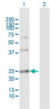 ARL4D MaxPab rabbit polyclonal antibody (D01)