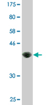 AREG monoclonal antibody (M06), clone 3E4