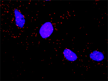 ARAF monoclonal antibody (M05), clone 3E2