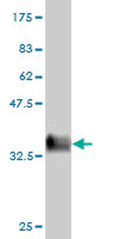 ARAF monoclonal antibody (M05), clone 3E2