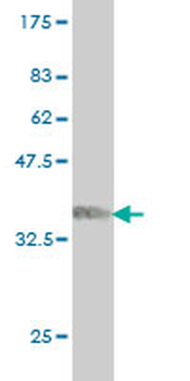 ARAF monoclonal antibody (M04), clone 3G2