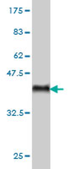 ARAF monoclonal antibody (M02), clone 5H8