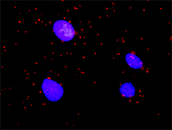 ARAF purified MaxPab rabbit polyclonal antibody (D01P)