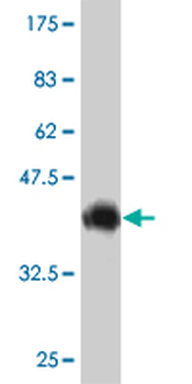 ABCC6 monoclonal antibody (M02), clone 5D8