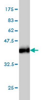 ABCC6 monoclonal antibody (M01), clone 1E6