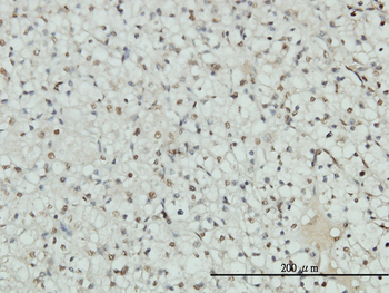 AR monoclonal antibody (M01), clone 1G3