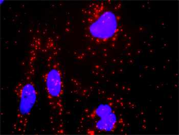 AR monoclonal antibody (M01), clone 1G3