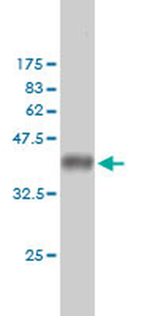 AR monoclonal antibody (M01), clone 1G3