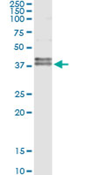 FAS monoclonal antibody (M01), clone 5B4