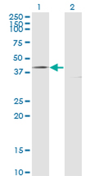 FAS monoclonal antibody (M01), clone 5B4