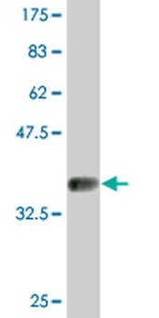 FAS monoclonal antibody (M01), clone 5B4