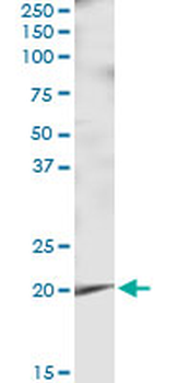 APRT MaxPab rabbit polyclonal antibody (D01)
