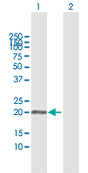 APRT MaxPab rabbit polyclonal antibody (D01)