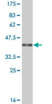 APOH monoclonal antibody (M01A), clone 3F10