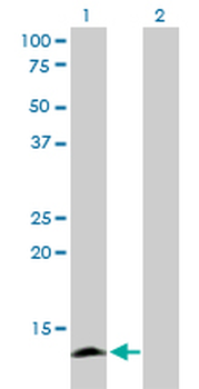 APOC4 monoclonal antibody (M01), clone 3D10