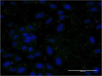 APOC3 monoclonal antibody (M06), clone 8H7