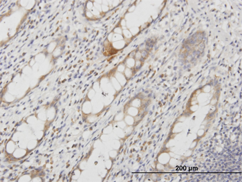 AQP8 monoclonal antibody (M03), clone 1F8