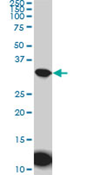AQP8 monoclonal antibody (M01), clone 1A1