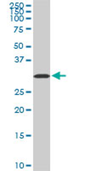 AQP8 monoclonal antibody (M01), clone 1A1